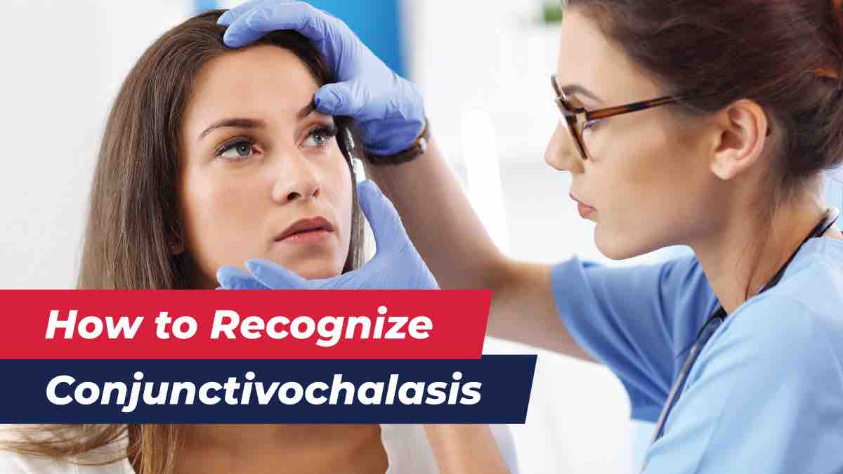 How to Recognize Conjunctivochalasis