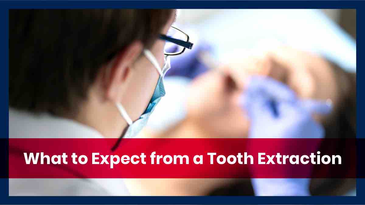 What to Expect from a Tooth Extraction