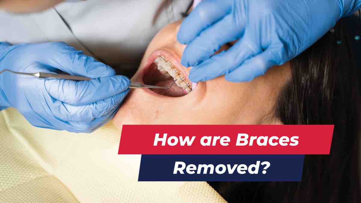 Patient getting braces removed