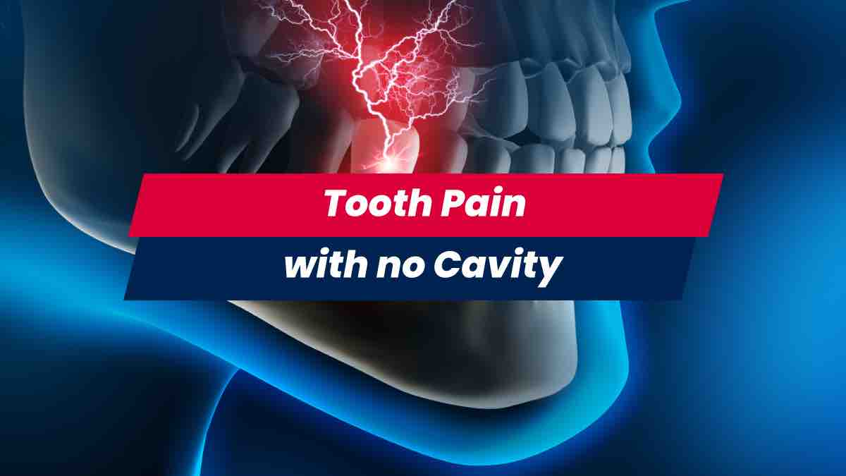 Tooth pain with no cavity present and nerve roots inflamed