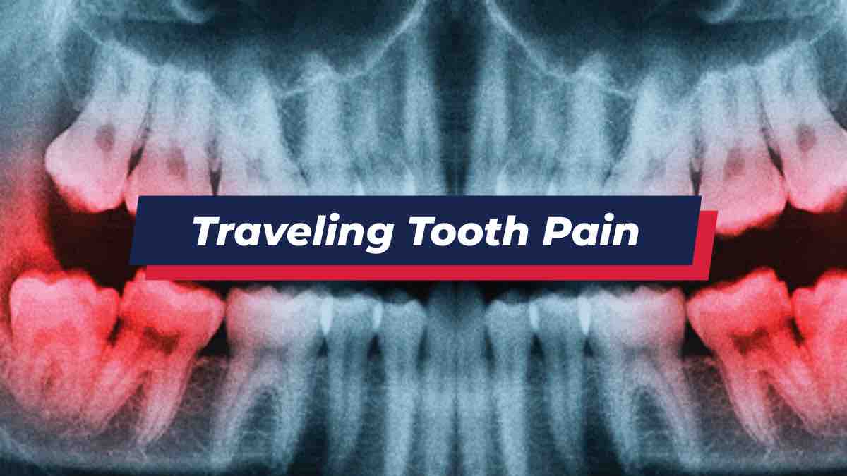 X-ray showing traveling tooth pain