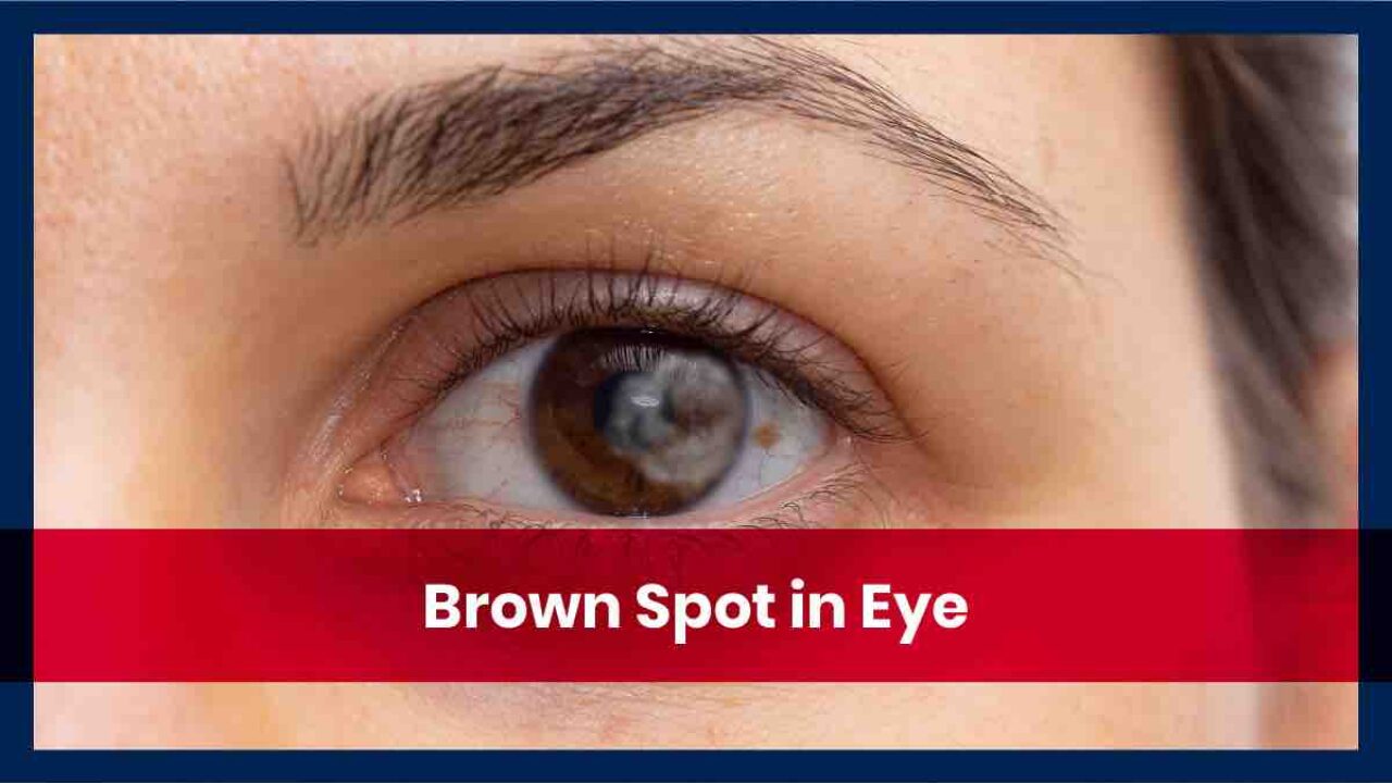 What Causes Brown in Eyes?
