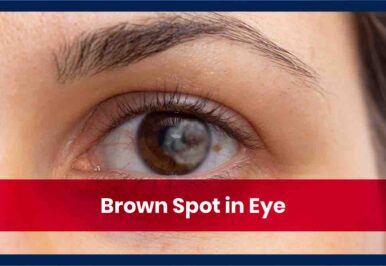 a close up of a persons brown colored eye with a brown spot on their eye on the right side